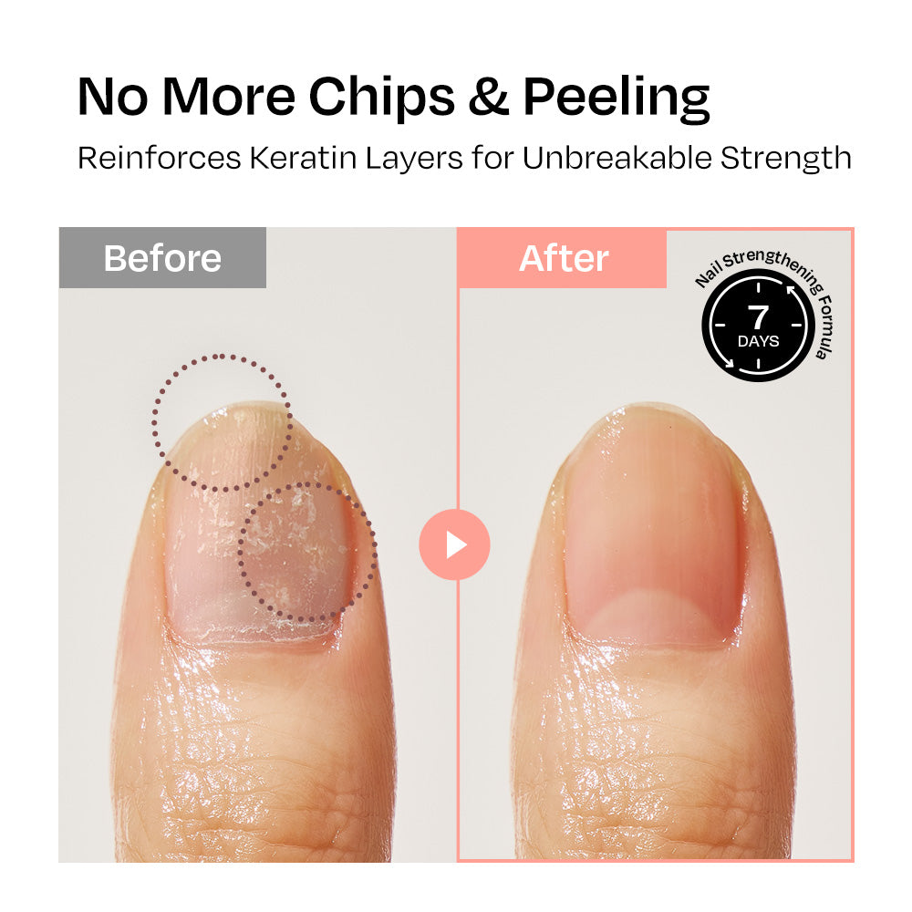 [Rosehip] Nail Strengthener