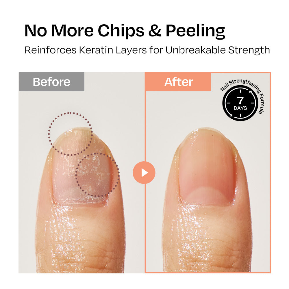 [Apricot] Nail Strengthener