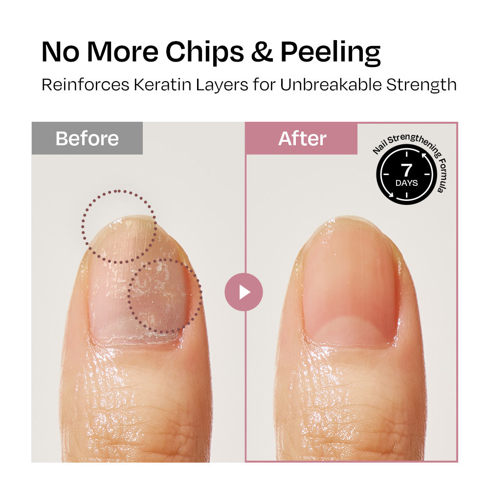 [Taro] Nail Strengthener